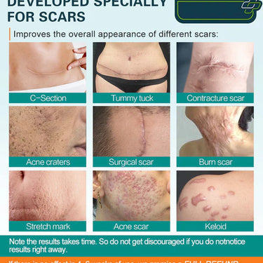 Scar-Free Skin, Faster Than Ever – The Ultimate Advanced Scar Spray