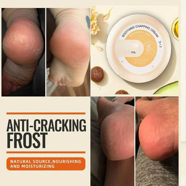 SkinSoothe™ - Transforms Dry, Cracked Skin Into Silky Smooth Perfection (+ FREE Mystery gift)