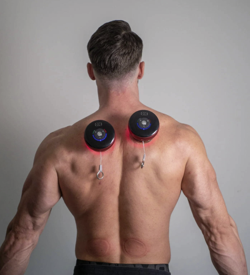 CupPro™️ - Smart Cupping Massager