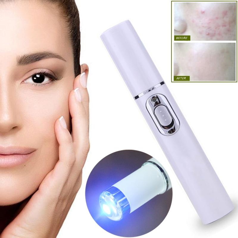 Blue Light Laser Pen for Spots, Scars & Blemishes